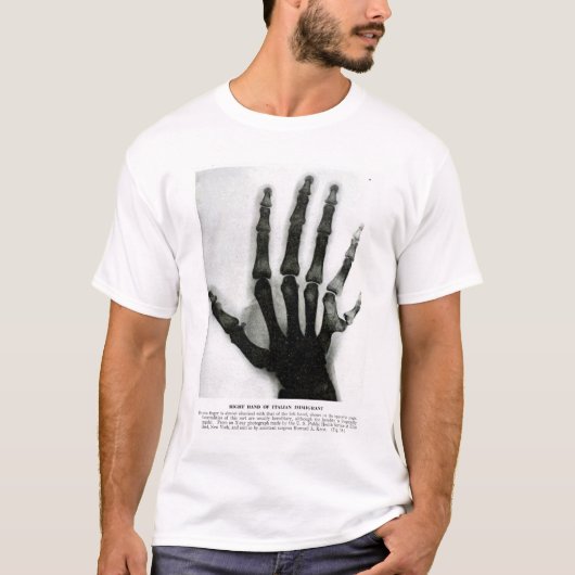 Röntgenhandje met extra vingers Shirt (Voorkant)