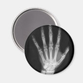 Röntgenplaat B&W Magneet (Voorkant / Achterkant)