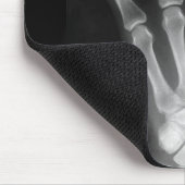 Röntgenplaat B&W Muismat (Hoek)