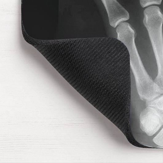 Röntgenplaat B&W Muismat (Hoek)