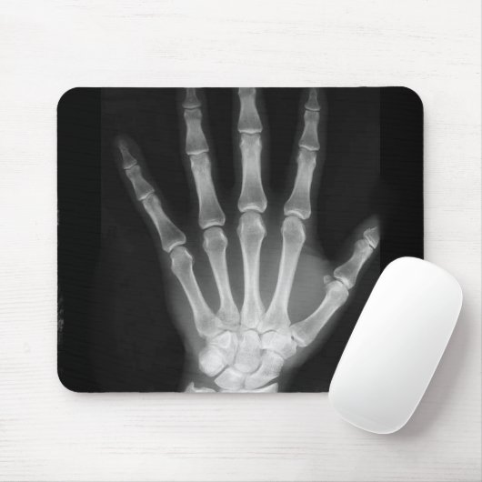 Röntgenplaat B&W Muismat (Met muis)