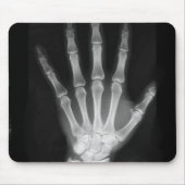 Röntgenplaat B&W Muismat (Voorkant)