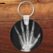 Röntgenplaat B&W Sleutelhanger (Voorkant)
