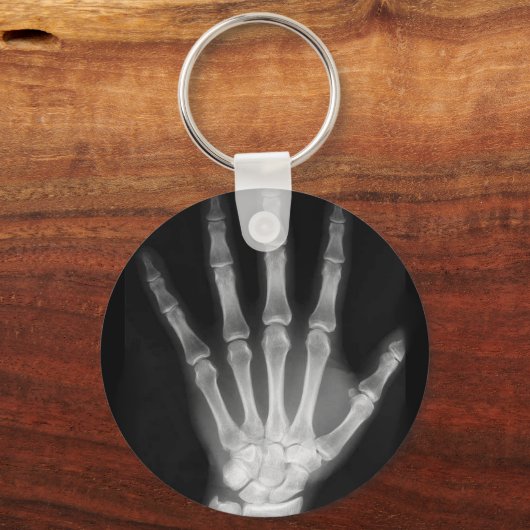 Röntgenplaat B&W Sleutelhanger (Voorkant)