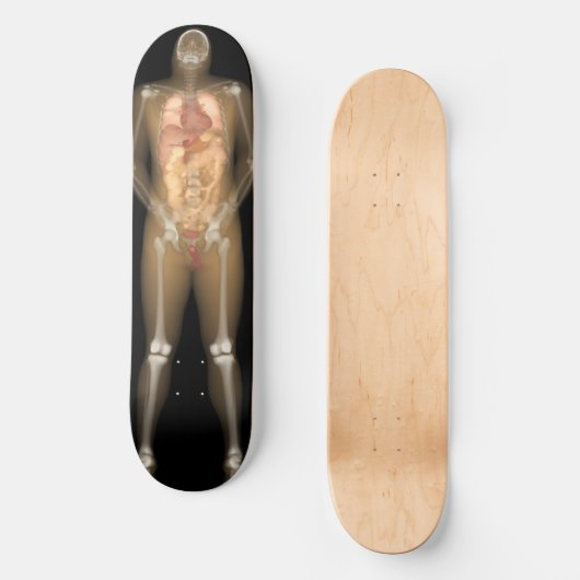 Röntgenplaat Man - Longboard Skateboard (Voorkant)