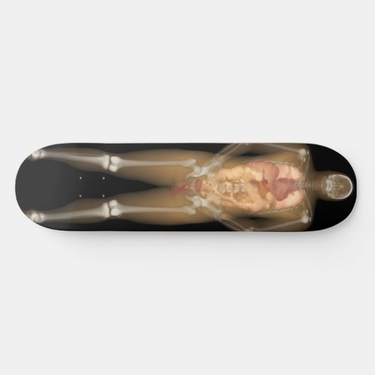 Röntgenplaat Man - Longboard Skateboard (Horizontaal)