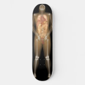 Röntgenplaat Man - Longboard Skateboard (Voorkant)