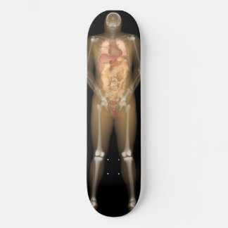 Röntgenplaat Man - Longboard Skateboard