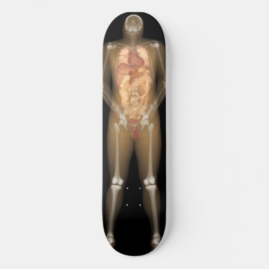 Röntgenplaat Man - Longboard Skateboard (Voorkant)