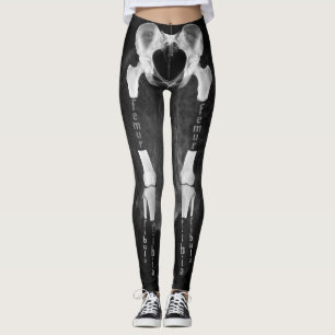 Röntgenradiologie medische anatomie skeleton legg leggings