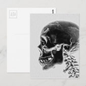 Röntgenschedel Briefkaart (Voorkant / Achterkant)