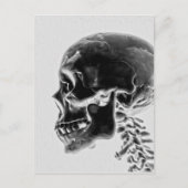 Röntgenschedel Briefkaart (Voorkant)