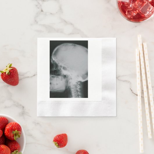 Röntgenschedel Servetten (Insitu)