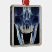 Röntgenstijl: kijk naar menselijke tanden metalen ornament (Rechts)