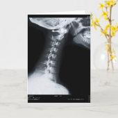 Röntgenstraal van halsruggewervels met inbegrip kaart (Gele Bloem)