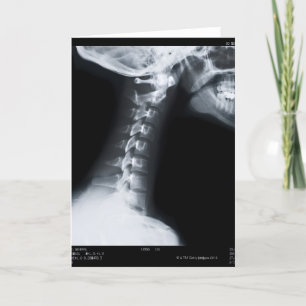 Röntgenstraal van halsruggewervels met inbegrip kaart