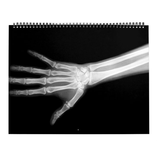 Röntgenstralen skelet zwart-wit kalender (Hoes)