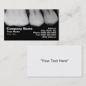 Röntgenstralen Visitekaartje (Voorkant / Achterkant)