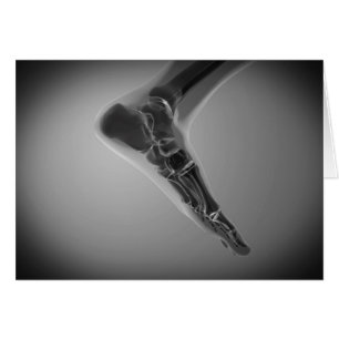 röntgenUitzicht van menselijke voet 4