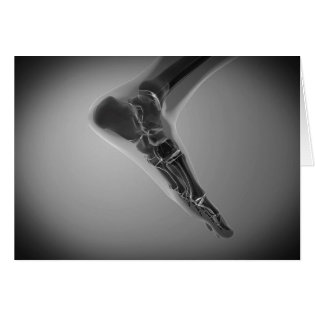 röntgenUitzicht van menselijke voet 4 (Voorkant Horizontaal)