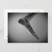 röntgenUitzicht van menselijke voet 4 Briefkaart (Voorkant / Achterkant)