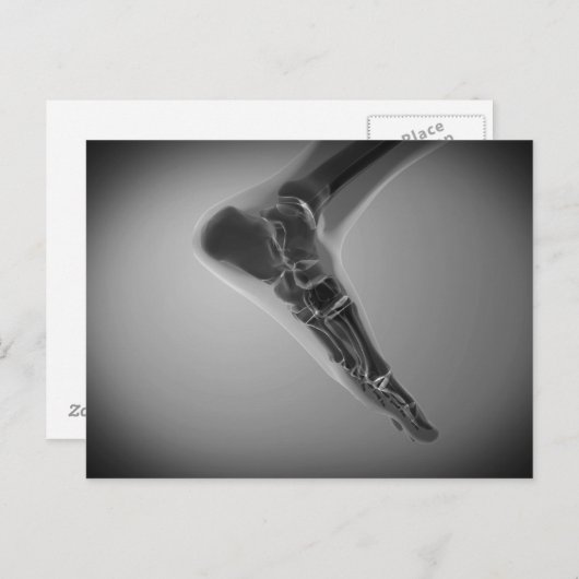 röntgenUitzicht van menselijke voet 4 Briefkaart (Voorkant / Achterkant)