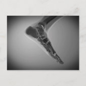 röntgenUitzicht van menselijke voet 4 Briefkaart (Voorkant)