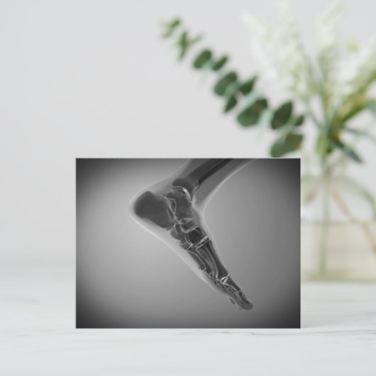 röntgenUitzicht van menselijke voet 4 Briefkaart (Staand voorkant)