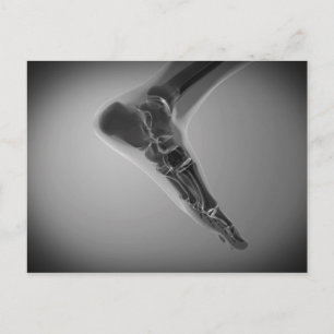röntgenUitzicht van menselijke voet 4 Briefkaart