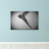 röntgenUitzicht van menselijke voet 4 Canvas Afdruk (Insitu (Houten vloer))