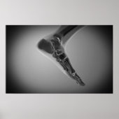 röntgenUitzicht van menselijke voet 4 Poster (Voorkant)