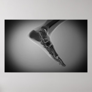 röntgenUitzicht van menselijke voet 4 Poster