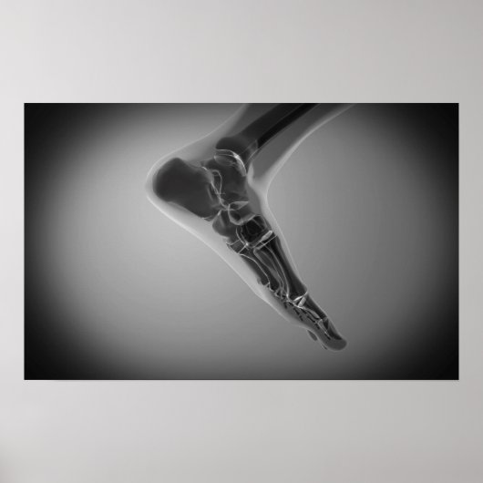 röntgenUitzicht van menselijke voet 4 Poster (Voorkant)