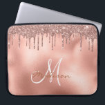 Roos Gold Glitter Drivers Monogram Laptop Sleeve<br><div class="desc">Dit ontwerp kan op het gebied worden gepersonaliseerd dat door de foto en/of tekst te veranderen wordt verstrekt. Of het kan worden aangepast door te klikken deze Sjabloon personaliseert en dan de klik te kiezen om verdere optie aan te passen en de kleur van de achtergrond te schrappen of te...</div>