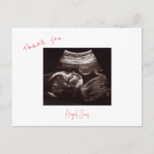 Roze Baby shower Echografie Dank u Briefkaart (Voorkant)