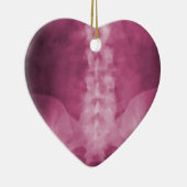 Roze digitale röntgenfoto's keramisch ornament (Rechts)