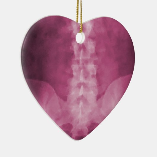 Roze digitale röntgenfoto's keramisch ornament (Rechts)