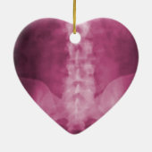 Roze digitale röntgenfoto's keramisch ornament (Achterkant)