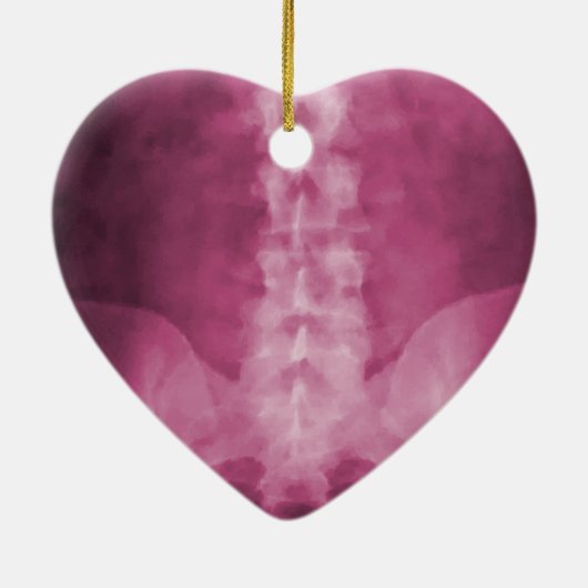 Roze digitale röntgenfoto's keramisch ornament (Achterkant)