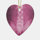 Roze digitale röntgenfoto's keramisch ornament (Links)