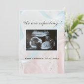 Roze en blauwe linten met ultrasone baby aankondiging (Staand voorkant)