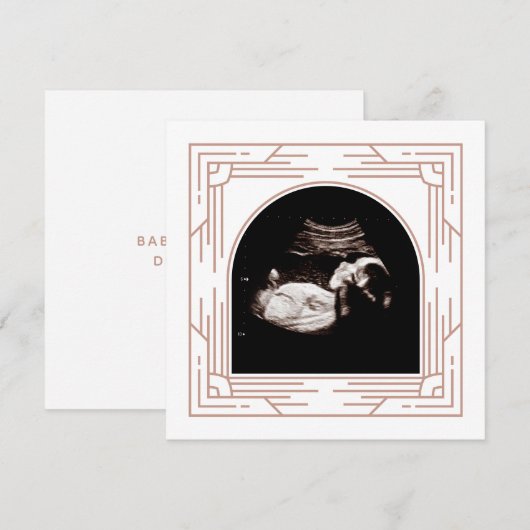  Roze Lijst Baby Sonogram Foto  Aankondiging (Voorkant / Achterkant)