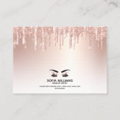 Roze mooie bruine ogen met gouden kroonnazorg aanbevelingskaartje (Achterkant)