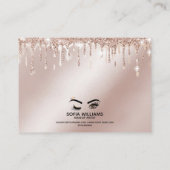 Roze mooie bruine ogen met gouden kroonnazorg aanbevelingskaartje (Achterkant)