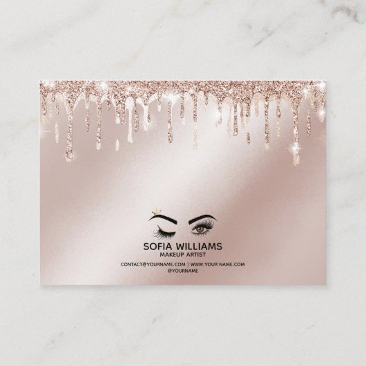 Roze mooie bruine ogen met gouden kroonnazorg aanbevelingskaartje (Achterkant)