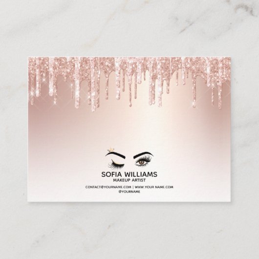 Roze mooie bruine ogen met gouden kroonnazorg aanbevelingskaartje (Achterkant)