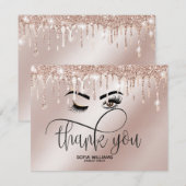 Roze mooie bruine ogen met gouden kroonnazorg bedankkaart (Voorkant / Achterkant)