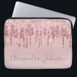 Roze Rose Gold Glitter Sparkle Monogram Laptop Sleeve<br><div class="desc">Blush Pink - Roos Gold Faux Dripping Glitter en Sparkle Elegant Monogram Girly Schattige Laptop Computer Hoesje of Sleeve. Dit hoesje kan worden aangepast om uw handtekening script naam op te nemen.</div>