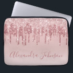 Roze Rose Gold Glitter Sparkle Monogram Laptop Sleeve<br><div class="desc">Blush Pink - Roos Gold Faux Dripping Glitter en Sparkle Elegant Monogram Girly Schattige Laptop Computer Hoesje of Sleeve. Dit hoesje kan worden aangepast om uw handtekening script naam op te nemen.</div>