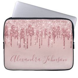Roze Rose Gold Glitter Sparkle Monogram Laptop Sleeve